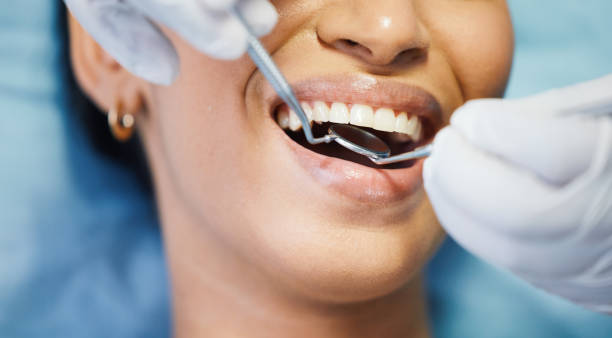 Best Broken or Cracked Tooth Emergency Dentist in Windermere, FL