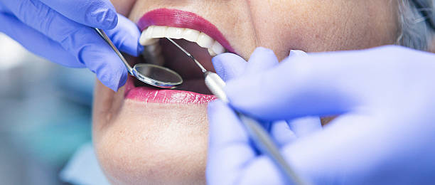 Best Emergency Dentist for Knocked-Out Tooth in Windermere, FL